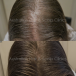 Hair Treatment Brisbane for Hair Health Support