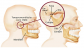 TMJ Treatment Melbourne for Jaw Pain Relief